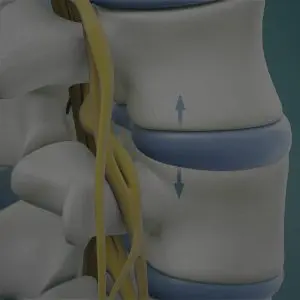 spinal disc illustration