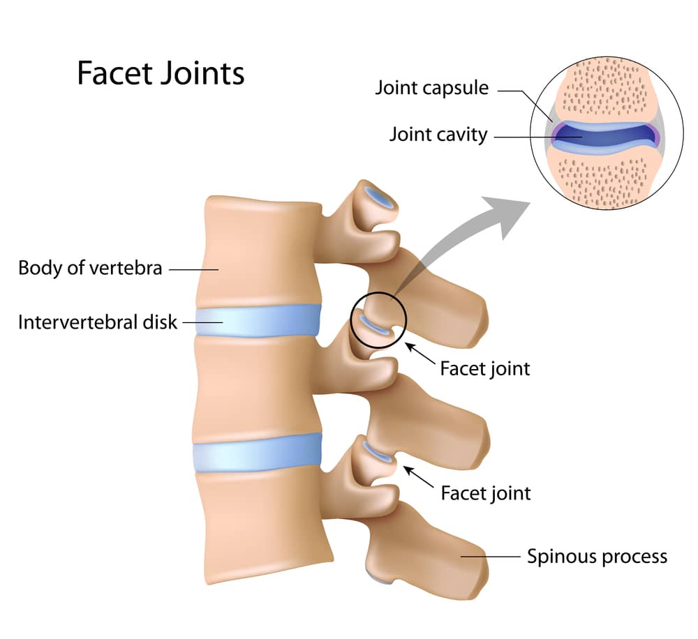 What Patients Should Know About Facet Joint Syndrome: Houston Spine