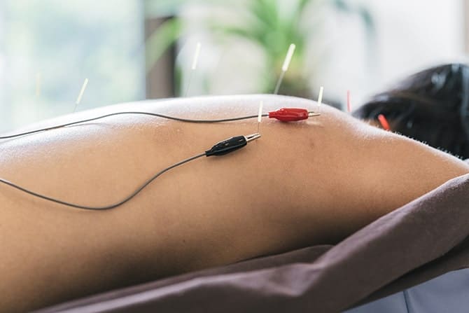 Dry Needling in the Woodlands & Houston