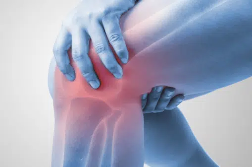 Medical illustration of a human knee with injury.