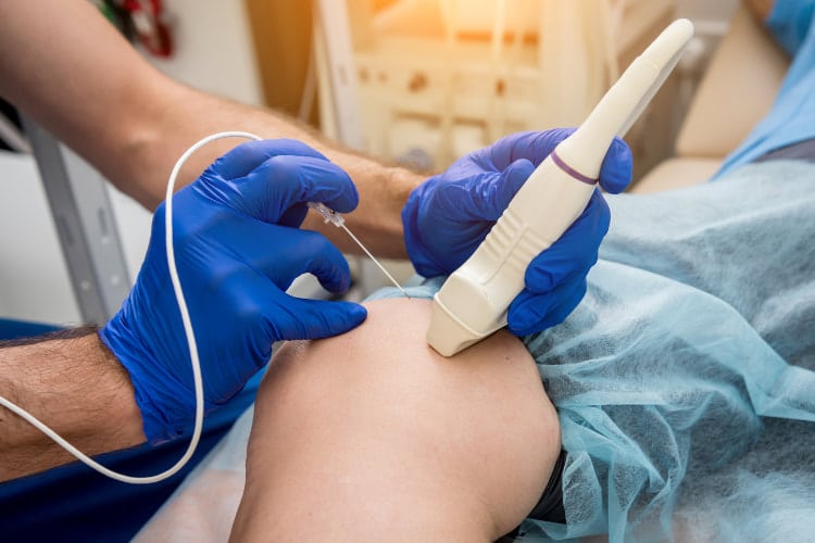 Doctor doing some Radiofrequency Ablation to the patient.