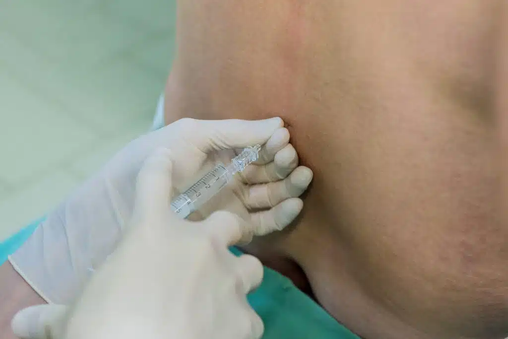 Lumbar nerve block injection.