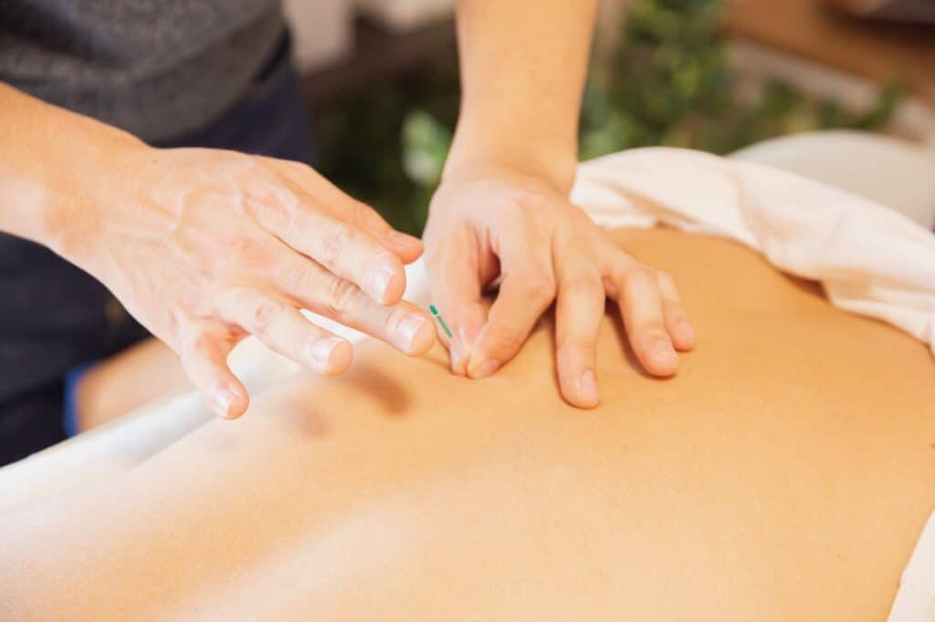 Dry needling therapy targeting muscle tension associated with scoliosis